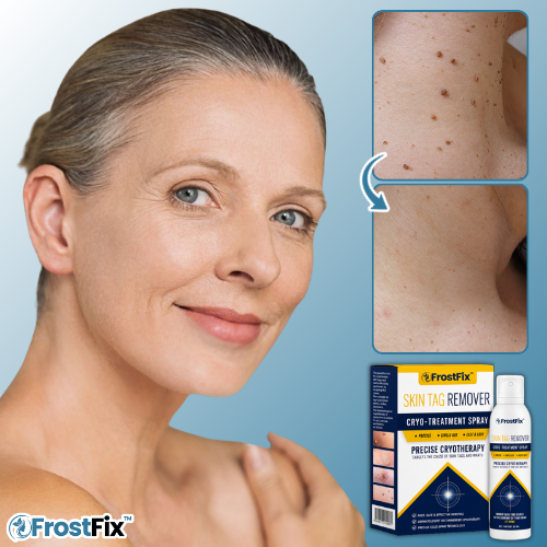 FrostFix™ Cryo Treatment Spray